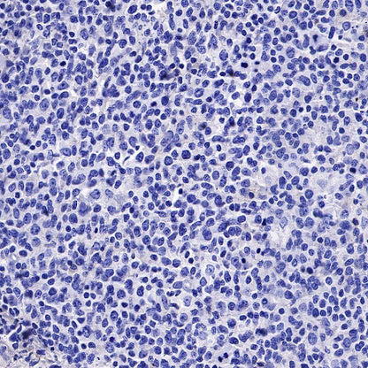 5T4 Recombinant Rabbit mAb (S-R361)