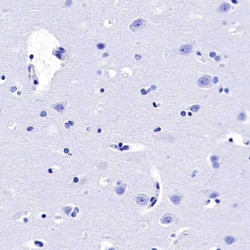 GLP-1 (active) Recombinant Rabbit mAb (S-R280)