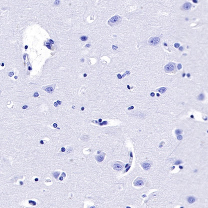 GLP-1 (active) Recombinant Rabbit mAb (S-R280)