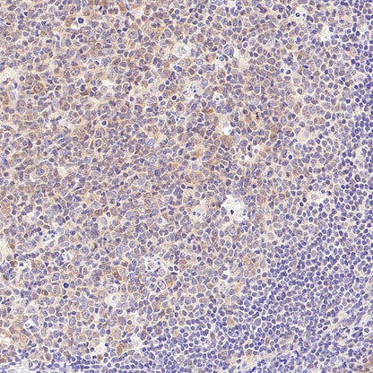 Smyd3 Recombinant Rabbit mAb (S-1507-61)