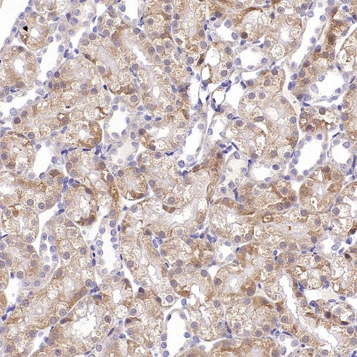 Rictor Recombinant Rabbit mAb (S-2601-26)