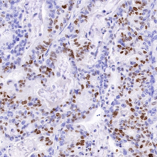 Ki67 Mouse mAb (SDT-606-33)