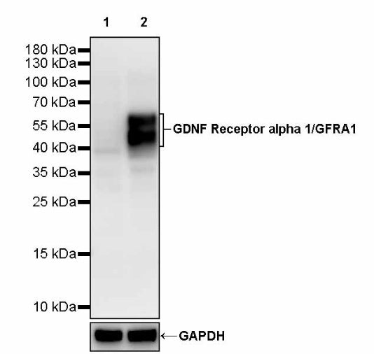 GDNF Receptor alpha 1/GFRA1 Recombinant Rabbit mAb (S-3289-52)
