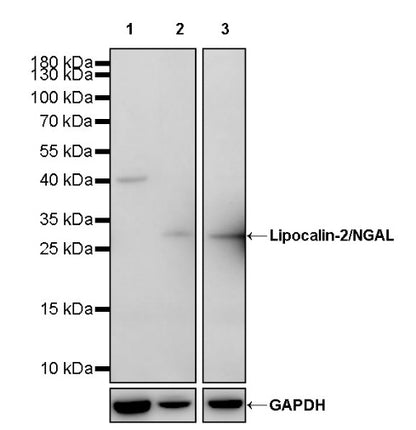 Lipocalin-2/NGAL Recombinant Rabbit mAb (S-2280-129)