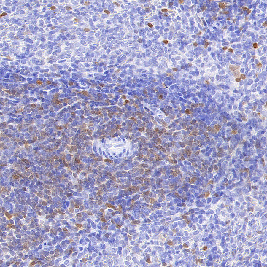 Stat4 Recombinant Rabbit mAb (S-4916-70)