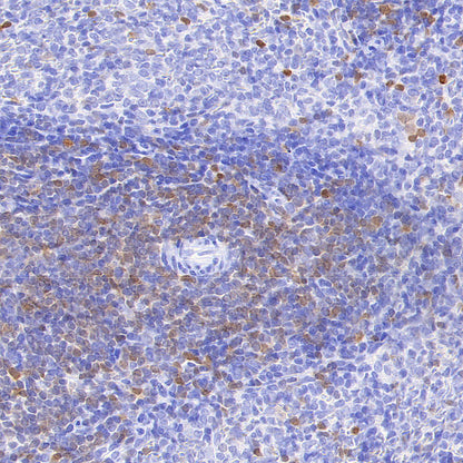 Stat4 Recombinant Rabbit mAb (S-4916-70)
