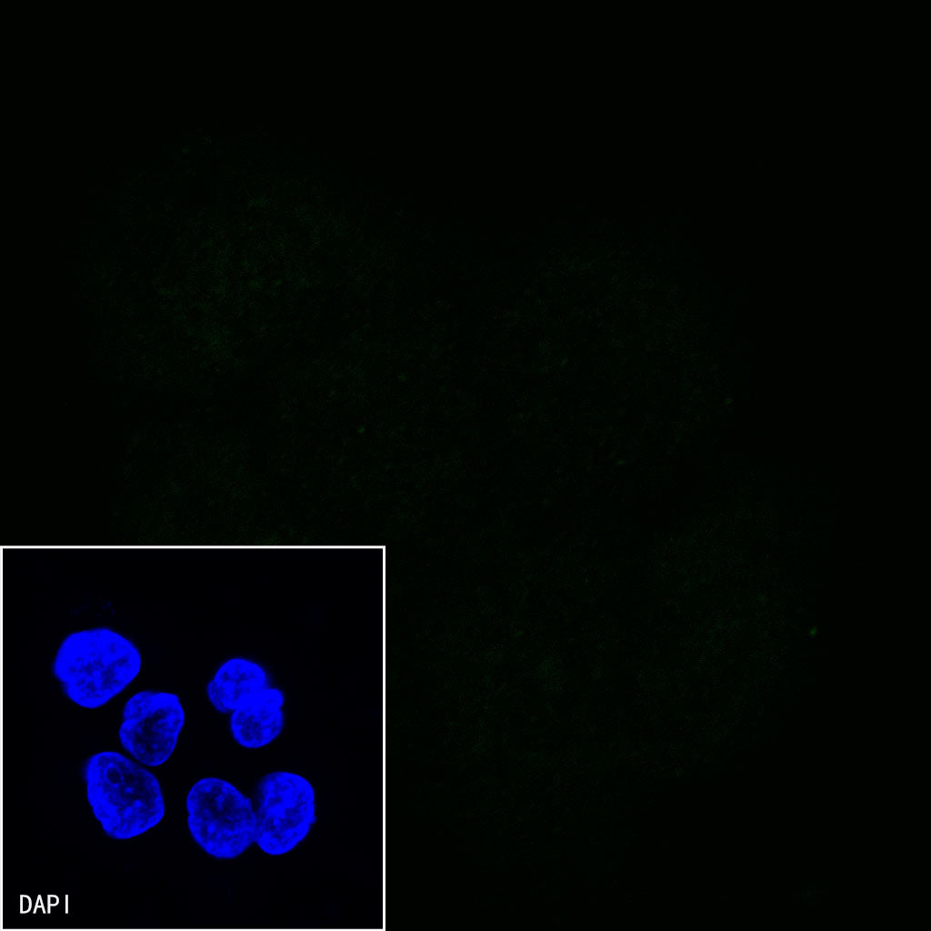 EGFR (delE746-A750) Recombinant Rabbit mAb (S-451-168)