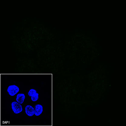 EGFR (delE746-A750) Recombinant Rabbit mAb (S-451-168)