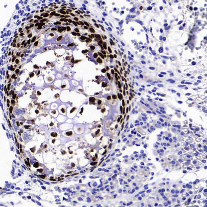 Sp7/Osterix Recombinant Rabbit mAb (S-4225-14)