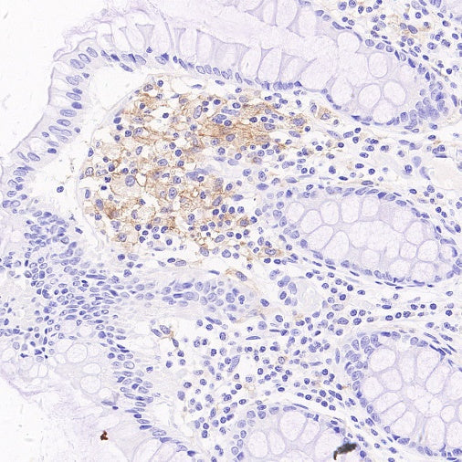 LILRB4 Recombinant Rabbit mAb (S-2504-22)