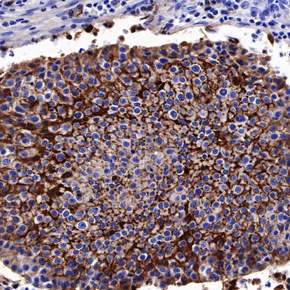 CD138 Recombinant Rabbit mAb,PBS Only (SDT-R120)