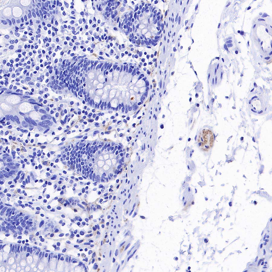 pan SCN Recombinant Rabbit mAb (S-5038)