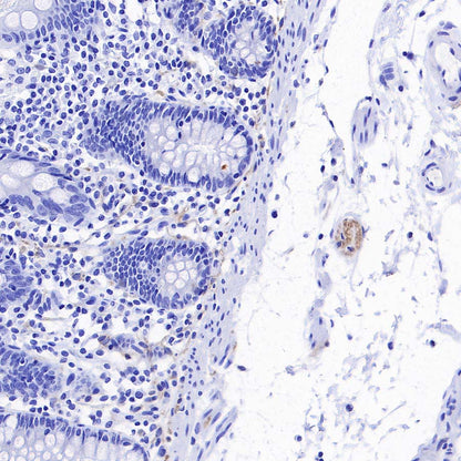 pan SCN Recombinant Rabbit mAb (S-5038)