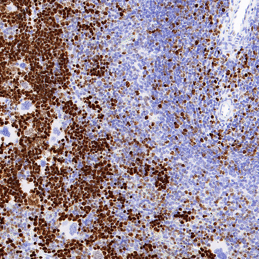 Ki67 Recombinant Rabbit mAb (S-4923-15)