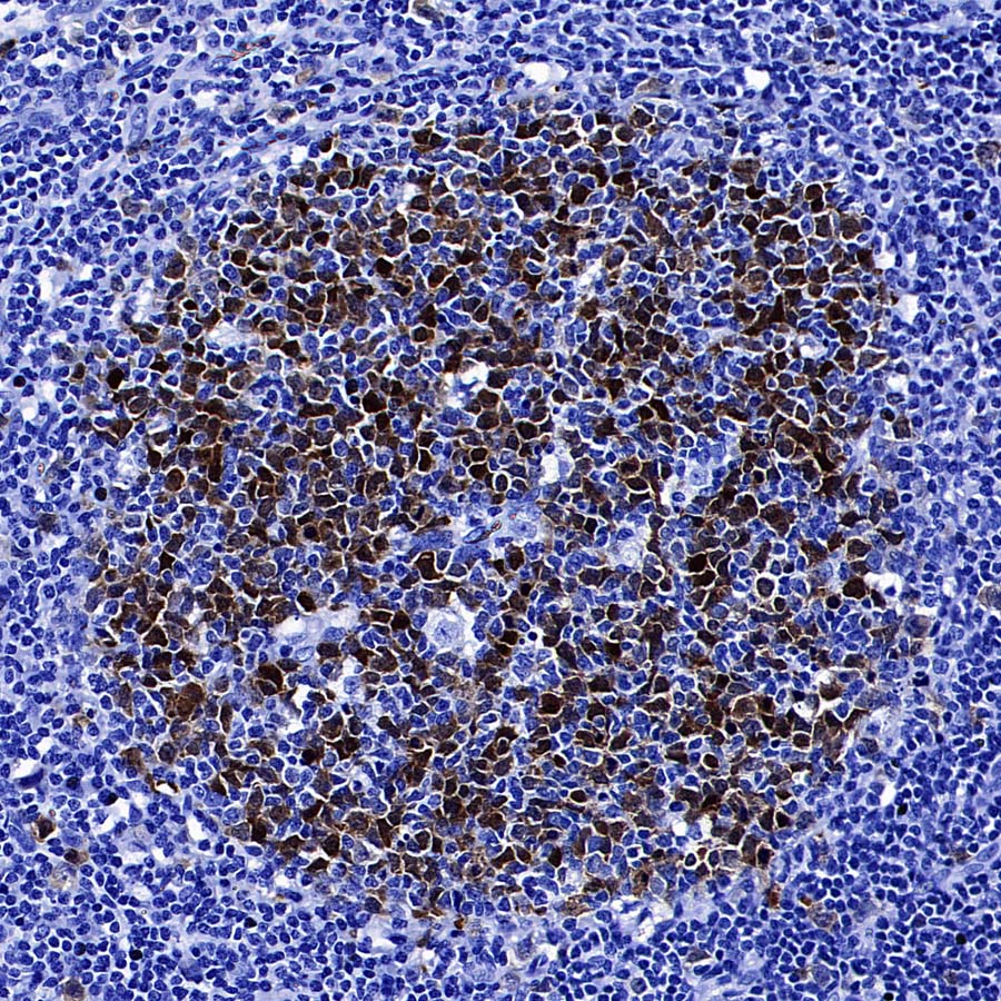 Thymidine Kinase 1 Recombinant Rabbit mAb (S-4127-43)