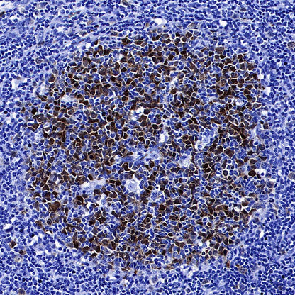 Thymidine Kinase 1 Recombinant Rabbit mAb (S-4127-43)