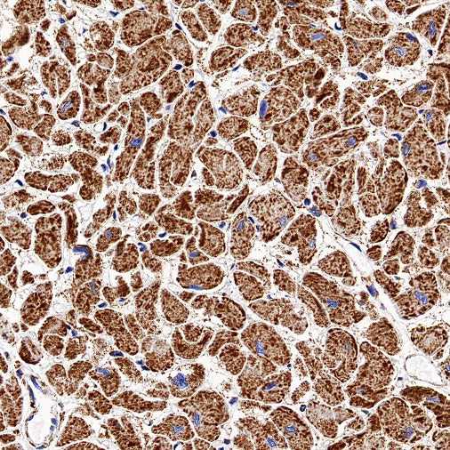 SDHB Recombinant Rabbit mAb (SDT-1162-2)