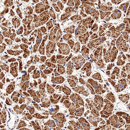 SDHB Recombinant Rabbit mAb (SDT-1162-2)