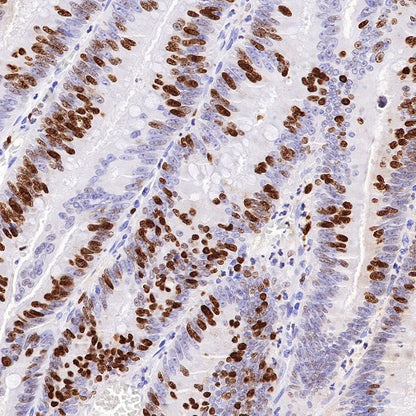 S-RMab® Ki67 Recombinant Rabbit mAb (SDT-10002)