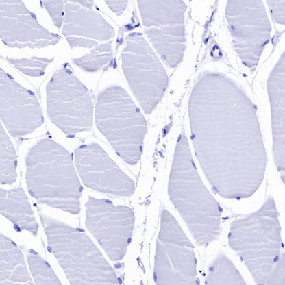 CD79a/MB-1 Recombinant Rabbit mAb (SDT-030-18)