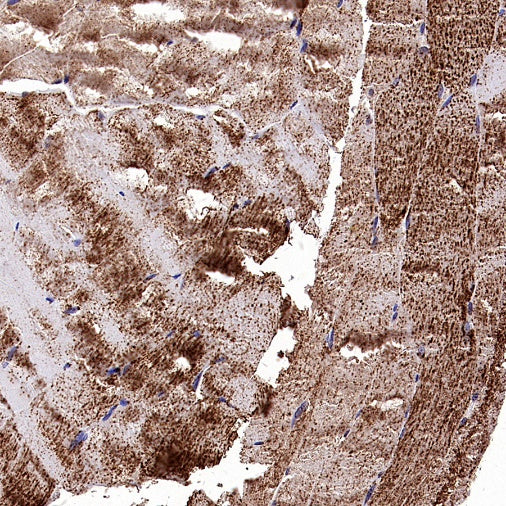 Fumarate hydratase Recombinant Rabbit mAb, PBS Only (SDT-2434-37)