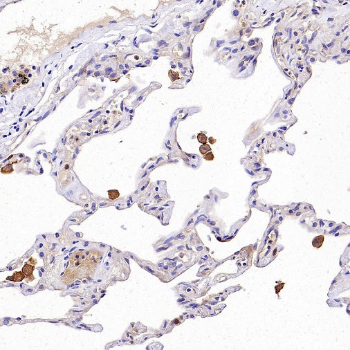 IFIT3 Recombinant Rabbit mAb (S-1893-45)