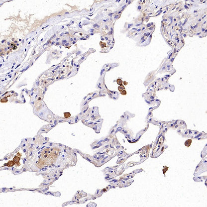 IFIT3 Recombinant Rabbit mAb (S-1893-45)
