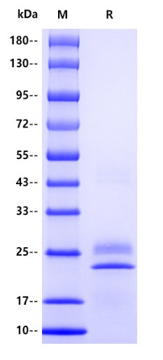 Human ferritin/FTL Protein, His tag