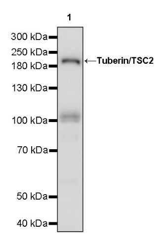 Tuberin/TSC2 Recombinant Rabbit mAb (S-1138-125)