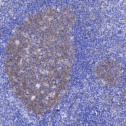 ENT1 Recombinant Rabbit mAb (SDT-R182)