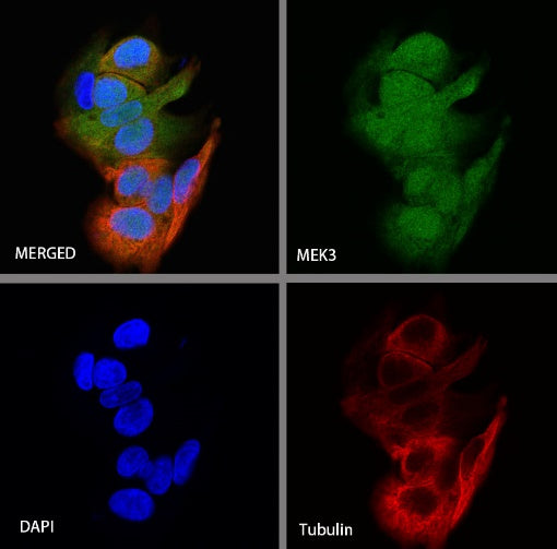 MEK3 Recombinant Rabbit mAb (S-835-23)