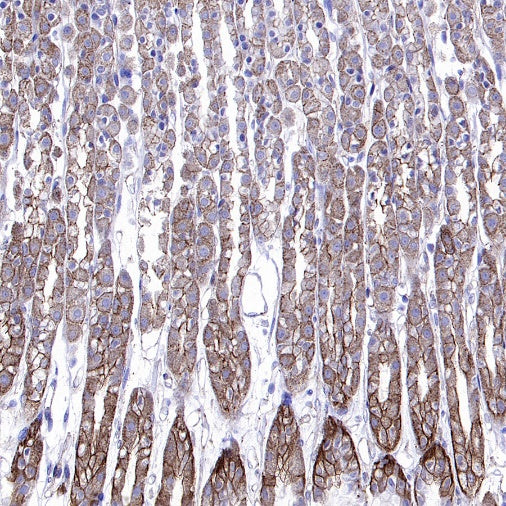 Cortactin Recombinant Rabbit mAb (S-1303-10)