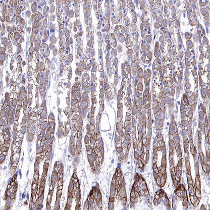 Cortactin Recombinant Rabbit mAb (S-1303-10)