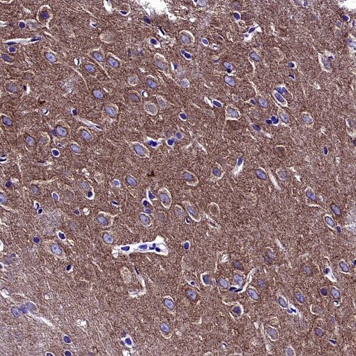p35/25 Recombinant Rabbit mAb (S-2719-47)