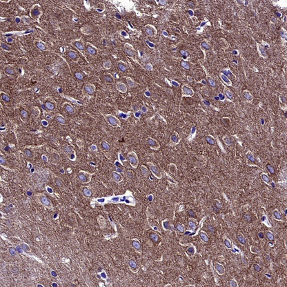 p35/25 Recombinant Rabbit mAb (S-2719-47)