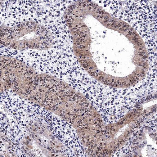 Stat3 Recombinant Rabbit mAb (S-1393-64)