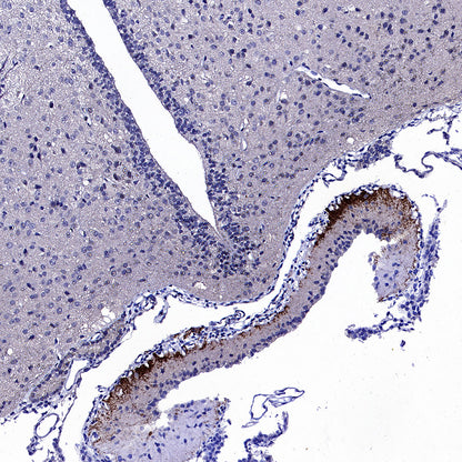 CRF Recombinant Rabbit mAb (S-5356)