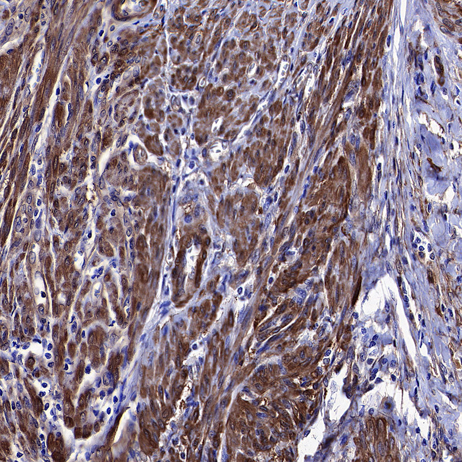 Vinculin Recombinant Rabbit mAb (S-5405)
