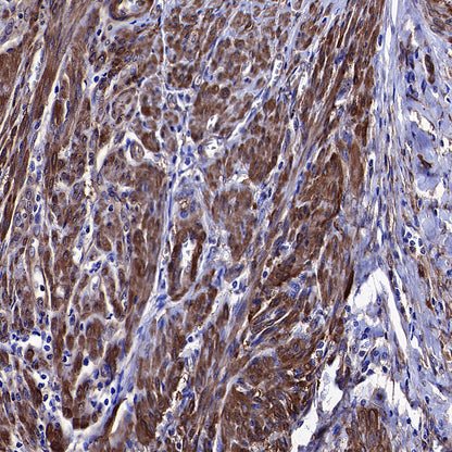 Vinculin Recombinant Rabbit mAb (S-5405)