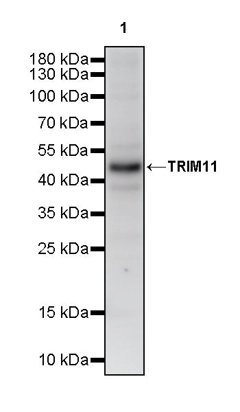 TRIM11 Recombinant Rabbit mAb (S-2913-79)