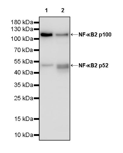 NF-κB2 p100/p52 Recombinant Rabbit mAb (S-2502-208)