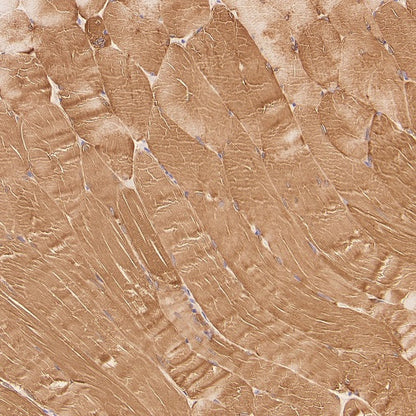 Glycogen Synthase Recombinant Rabbit mAb (S-2698-24)