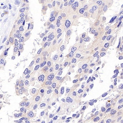ErbB3 Recombinant Rabbit mAb (SDT-991-14)
