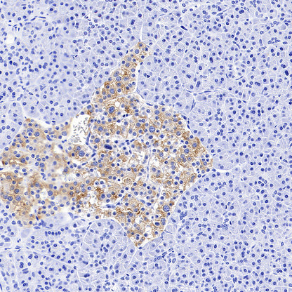 SV2A Recombinant Rabbit mAb (S-4049-16)