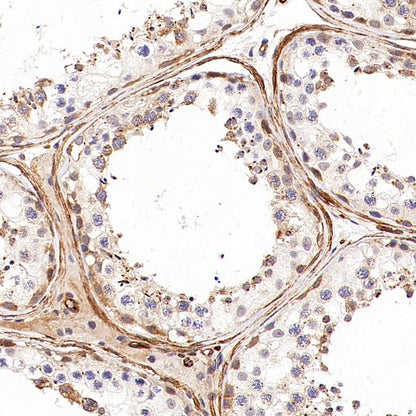 KIF18A Recombinant Rabbit mAb (S-3310-11)