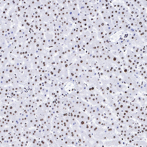 Histone H3 (di methyl K56) Recombinant Rabbit mAb (S-R427)