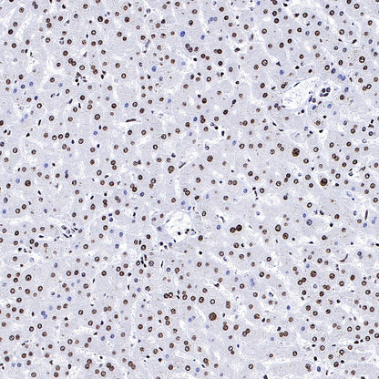 Histone H3 (di methyl K56) Recombinant Rabbit mAb (S-R427)