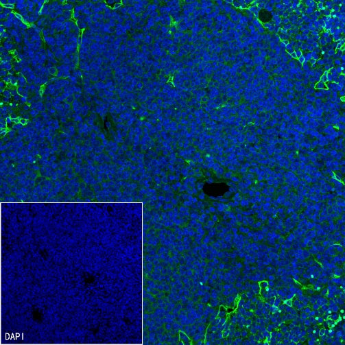 CD36 Recombinant Rabbit mAb (S-1028-127)