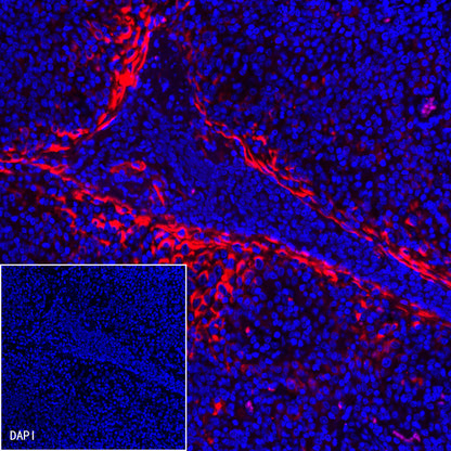 MUC1/EMA Mouse mAb (SDT-777-37)