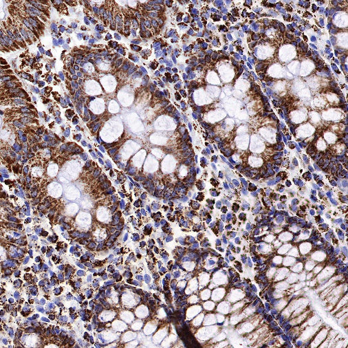 IDH2 Recombinant Rabbit mAb (S-1525-5)